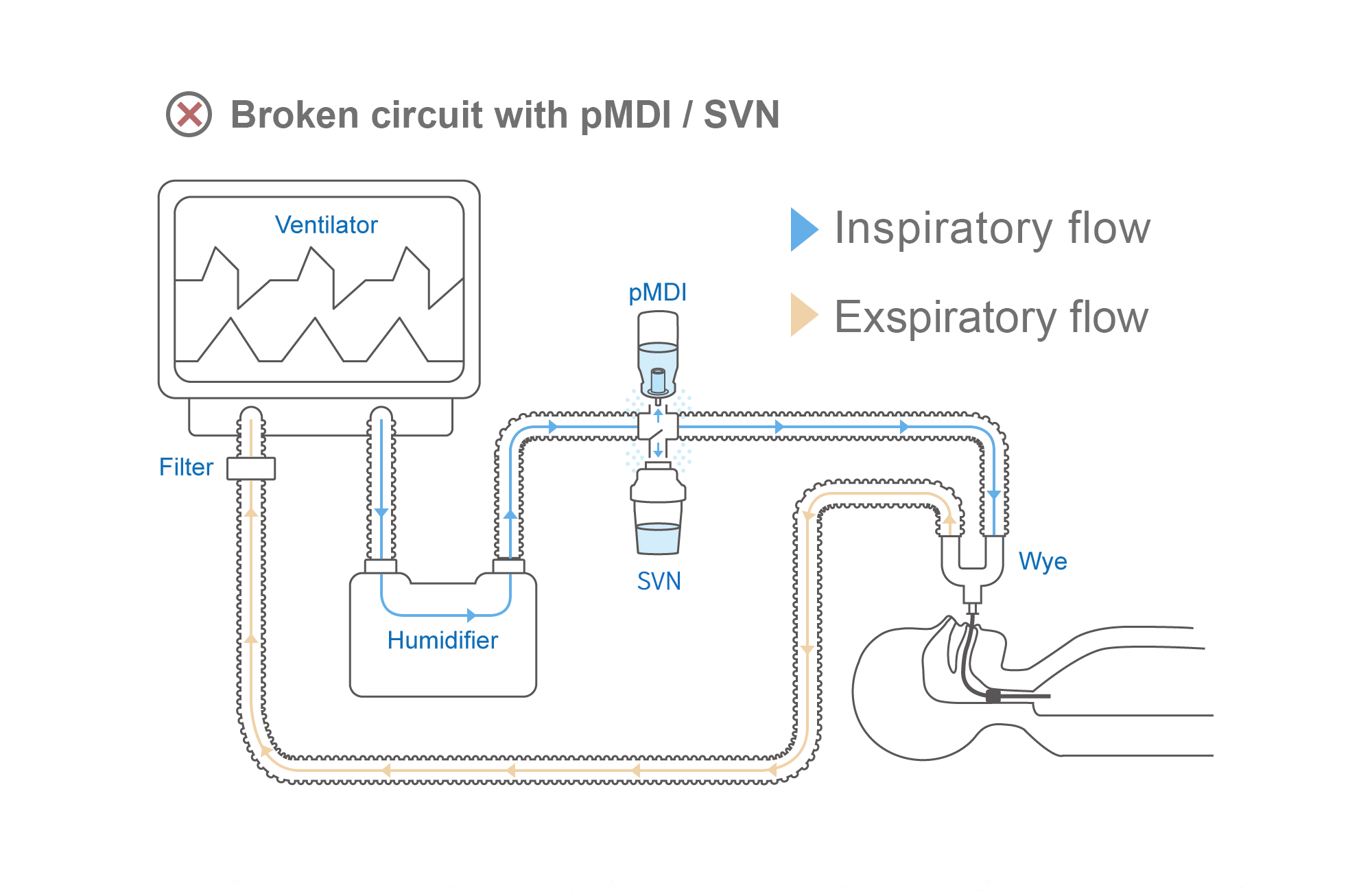 SVN/pMDI Airflow Animation